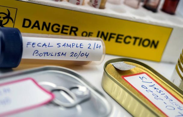 Samples contaminated by Clostridium botulinum toxin that causes botulism in humans, laboratory research, conceptual image - Photo, Image