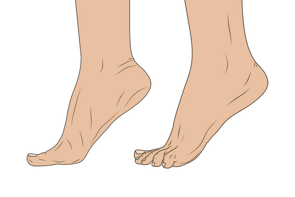 pies femeninos en la posición de los pies. Ilustración vectorial EPS10. Esquema
 - Vector, imagen