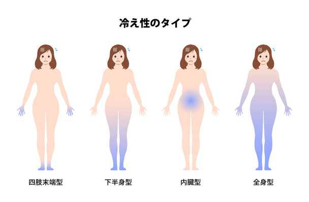Tipi di sensibilità al freddo / scarsa circolazione illustrazione vettoriale (giapponese) - Vettoriali, immagini