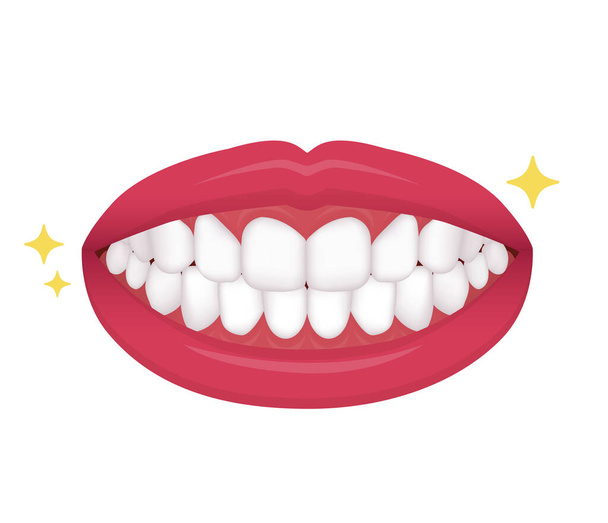 Dental braces vector illustration / no text - Vektor, Bild