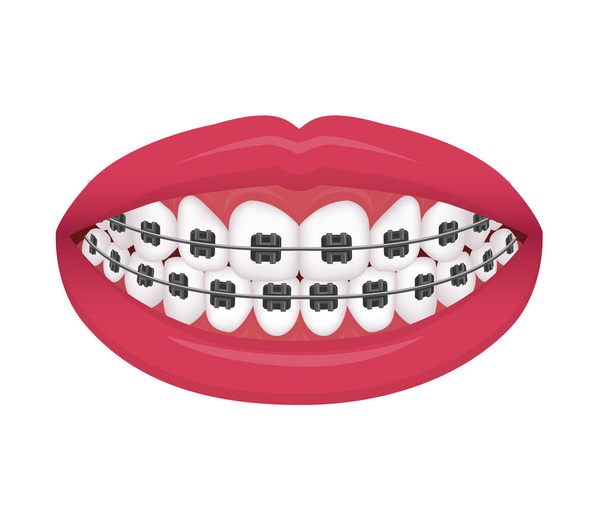 Bases dentárias ilustração vetorial / sem texto - Vetor, Imagem