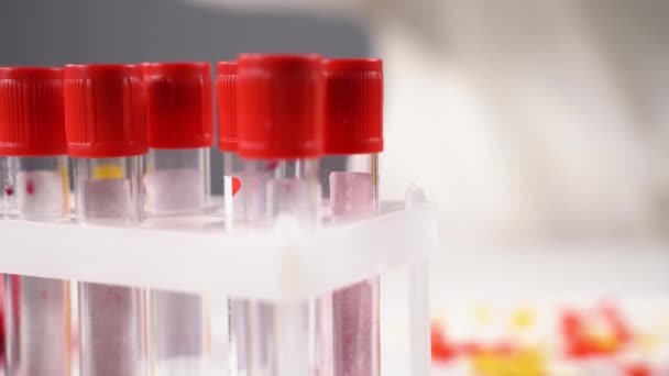 Станьте з пробними трубками для аналізу крові в дослідницькій медичній лабораторії. Тестова трубка з зразком крові розміщується в стійці для тестових труб на задньому плані лабораторії. Covid-19 або дослідження вірусу Corona. - Кадри, відео