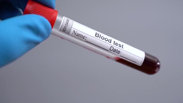 Technicien de laboratoire masculin avec des gants de protection tenant tube testant des échantillons de sang sur la salle d'hôpital pour la transfusion sanguine, les mains rapprochées. Test sanguin du virus Covid-19
 - Séquence, vidéo
