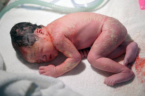 Крупним планом новонародженої азіатської китайської дитини з пупковим шнуром
 - Фото, зображення