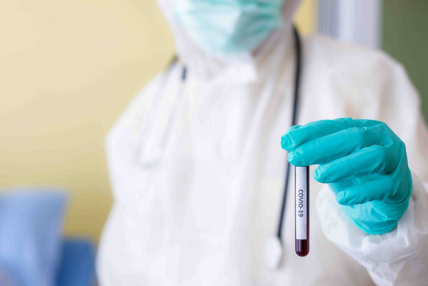 Kontrol bölgesindeki doktorun elindeki test tüpü kan örneğini kapat. COVID 19 'u olan hastalara bakım ve tedavi kavramları. - Fotoğraf, Görsel