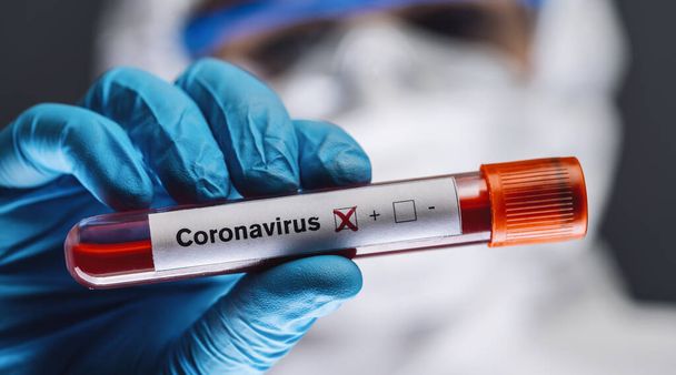 médico o enfermero con traje protector y protector facial con resultado positivo de análisis de sangre para coronavirus o covid-19
. - Foto, imagen