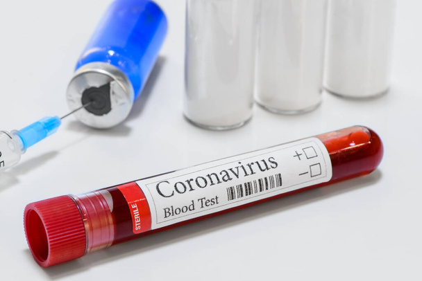 COVID-19 laboratory test tube and laboratory sample of blood testing for diagnosis coronavirus infection medicines and pharmacology nobody isolated - Foto, afbeelding