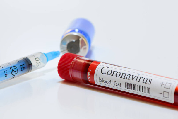 COVID-19 laboratory test tube and laboratory sample of blood testing for diagnosis coronavirus infection medicines and pharmacology nobody isolated - Photo, image
