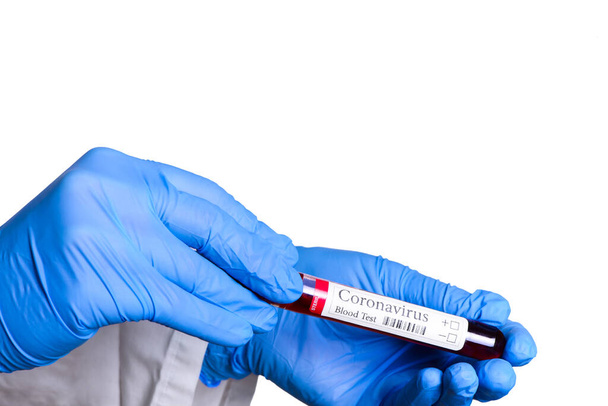 COVID-19 test and laboratory sample of blood testing for diagnosis coronavirus infection in the hands of the laboratory assistant isolated on white background and space for ads concept - Photo, image