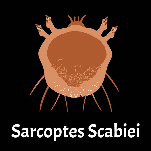 Sarcoptes scabiei-t. Rühösek. Szexuális úton terjedő betegség. Infografikák. illusztráció elszigetelt háttérrel. - Vektor, kép