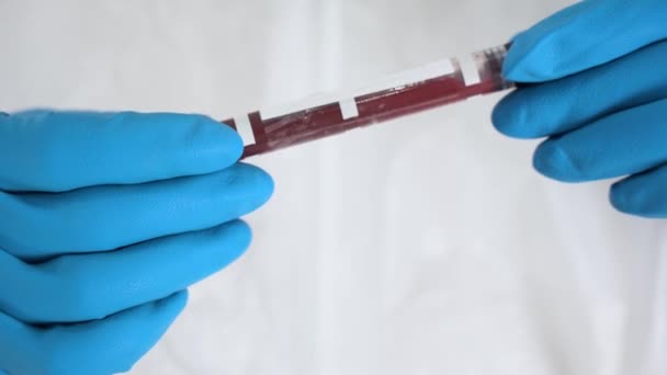 Detailní záběr lékař ruce zblízka. Nerozpoznatelná lékařka nosí bílé šaty, modré latexové rukavice, drží zkumavku s nebezpečným vzorkem krve s pozitivním výsledkem 2019-nCoV coronavirus threat. - Záběry, video