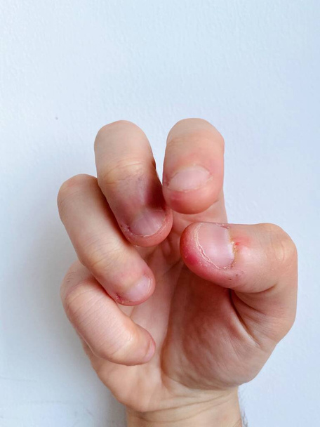 Неприємний огидний укус і лущення нігтів перед білим тлом з копіювальним простором
.  - Фото, зображення