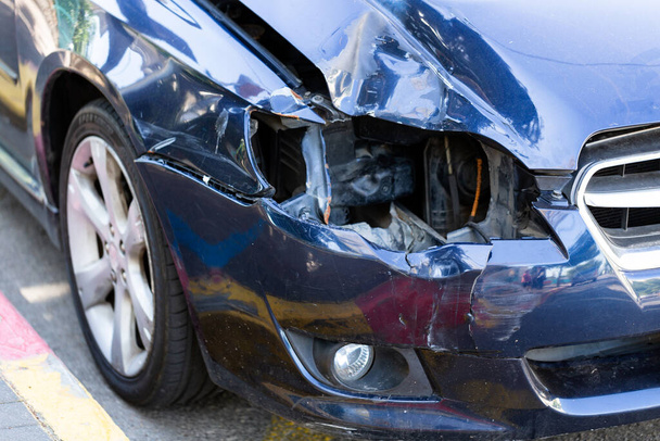 Autóbaleset vagy baleset. Első lökhárító egy kék autóból, könnyű sérülések és karcolások a lökhárítón. Törött jármű részlet, vagy közelről. egy kék autó törött fényszórója - Fotó, kép