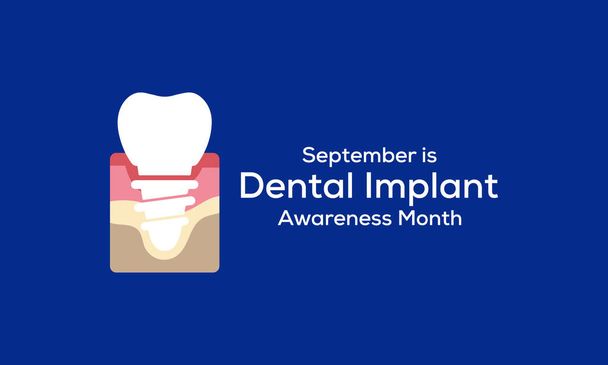 Ilustracja wektora na temat miesiąca świadomości implantu stomatologicznego obserwowanego każdego roku we wrześniu. - Wektor, obraz