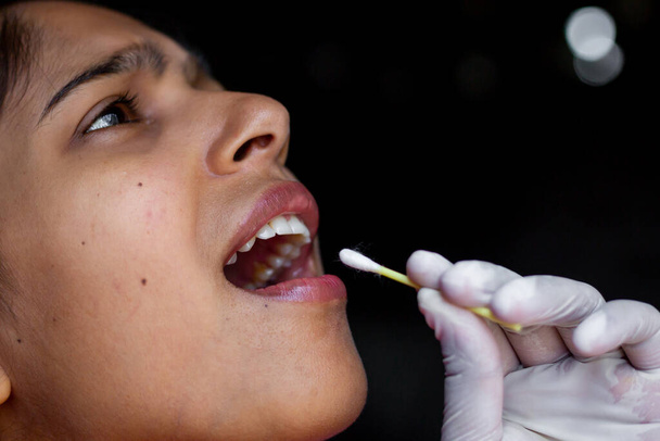 Lääkärin käsi ottaa sylki testi nuoren naisen suusta Cotton Swab. Coronavirus kurkkunäyte kokoelma. Lähikuvat. - Valokuva, kuva