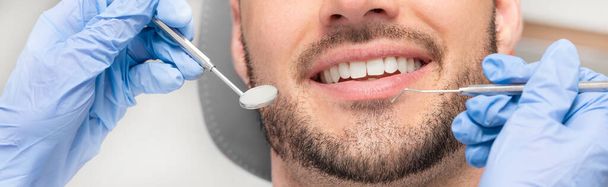 Man having teeth examined at dentists. Overview of dental caries prevention - Φωτογραφία, εικόνα