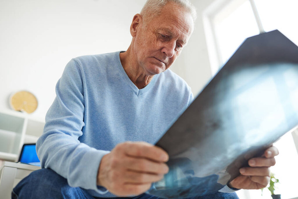 Lage hoek uitzicht op senior man met röntgenbeeld tijdens het wachten op overleg in de kliniek - Foto, afbeelding