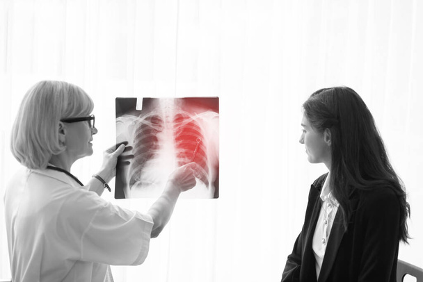El médico está investigando la radiografía de tuberculosis pulmonar con pacientes en hospitales. - Foto, imagen