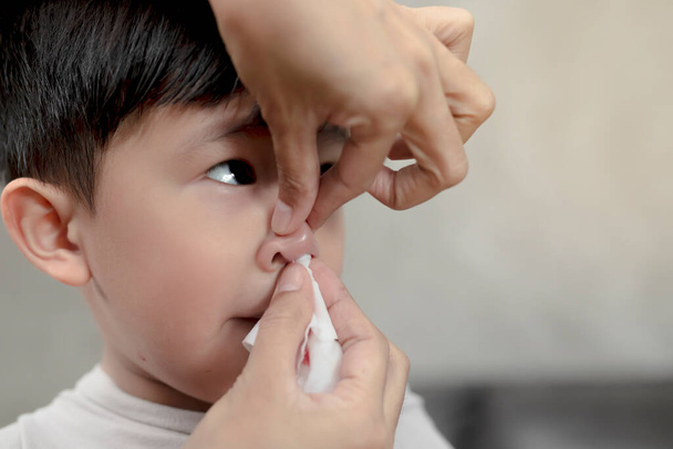 Söpö aasialainen etninen lapsi, jolla on nenäverenvuoto, Käsite ensiapu nenäverenvuotoon. - Valokuva, kuva