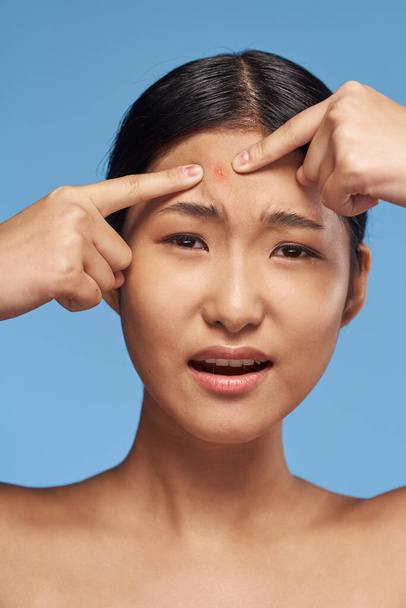 beautiful asian woman squeezing  a pimple - Fotoğraf, Görsel