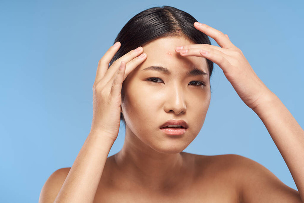 Giovane bella donna asiatica sconvolta per l'acne. Studio girato  - Foto, immagini