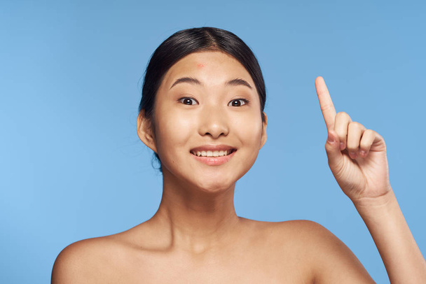 Young beautiful asian  woman with acne. Studio shot  - Фото, изображение