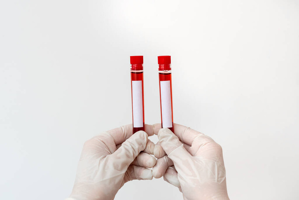 Técnico de laboratorio que sostiene el tubo de prueba de la muestra de sangre humana extraída para la herramienta de diagnóstico del riesgo de la salud. Concepto de análisis de investigación médica
 - Foto, imagen