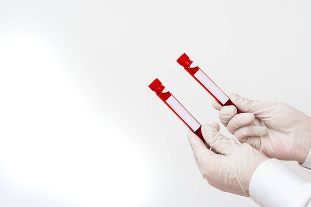 Laboratuvar teknisyeninin elinde çıkarılan kan örneği test tüpü var. Teşhis etme riski var. Tıbbi Araştırma Analizi Konsepti - Fotoğraf, Görsel