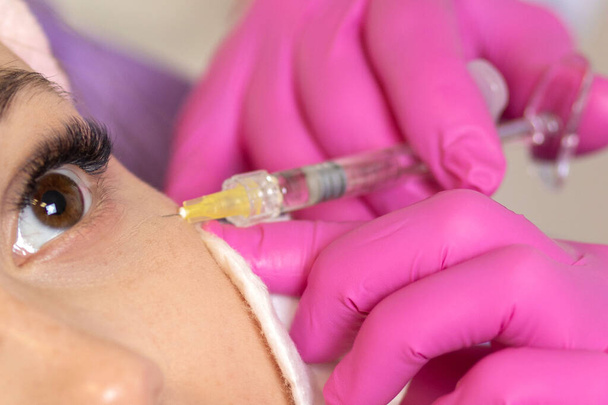 Woman getting cosmetic injection of botox near eyes, closeup. Woman in beauty salon. plastic surgery clinic. Cosmetology skin care - Zdjęcie, obraz