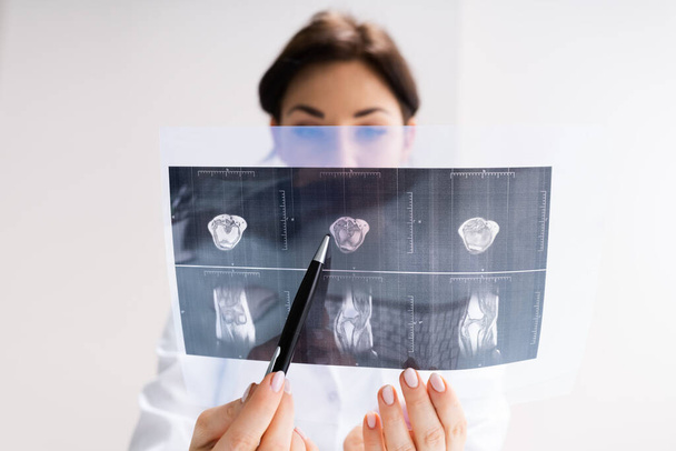 Médecin chirurgien tenant un balayage magnétique d'os de rayon X - Photo, image