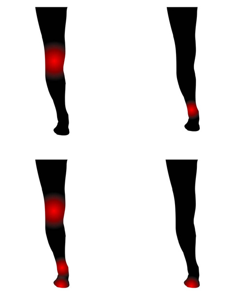 Ludzkie nogi z punktami bólu - Wektor, obraz