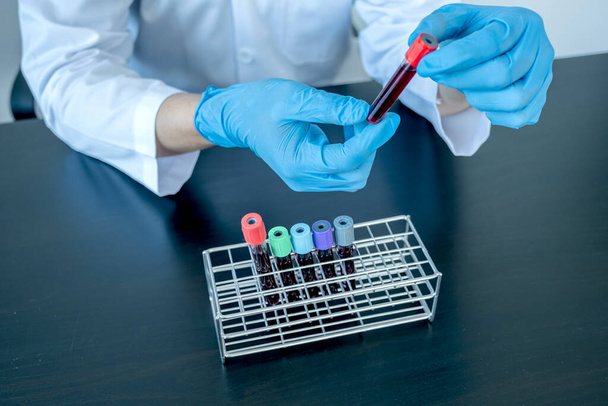 Ammattilaiset lääkärit suorittavat löytää virustestit näytteistä verikokeita diagnosoida sepelvaltimovirusinfektioiden analysointi ja näytteenotto tartuntatautien. - Valokuva, kuva