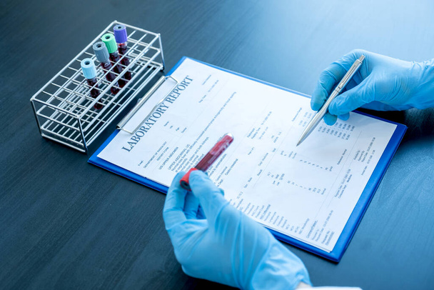 Professional doctors perform find virus tests from samples of blood tests to diagnose coronary virus infections analysis and sampling of infectious. - Photo, image