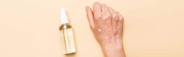 panoramisch shot van vrouwelijke hand met droge, geexfolieerde huid bij antiseptische spray op beige - Foto, afbeelding