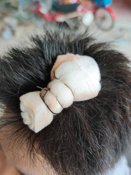 zblízka asijské muž zranění hlavy s stehem a gázou - Fotografie, Obrázek