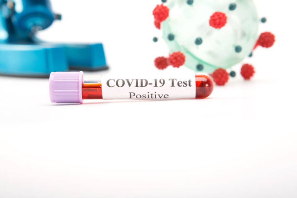 Test tube with a positive COVID-19 test on a white background - Photo, image