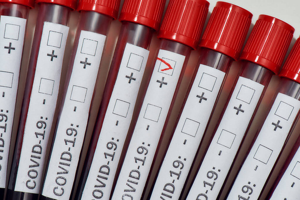 Close up of positive COVID19 test among tubes containing a blood test sample over grey background. Testing for new virus infection, Covid 19. Coronavirus concept - Foto, afbeelding