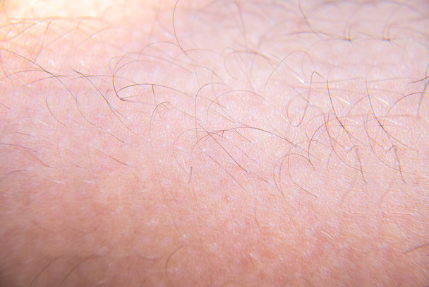 Cabelo de perto na pele humana, textura de fundo
 - Foto, Imagem