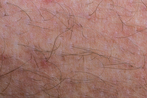 Деталь людської шкіри з волоссям, крупним планом, макросом
. - Фото, зображення