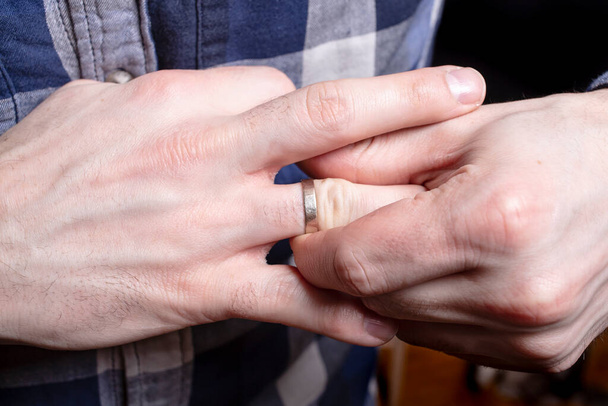 man worstelt met het verwijderen van trouwring uit zijn vinger - Foto, afbeelding