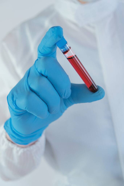Teste de sangue para vírus. assistente de laboratório em um terno protetor e máscara com um tubo de teste de análises
 - Foto, Imagem