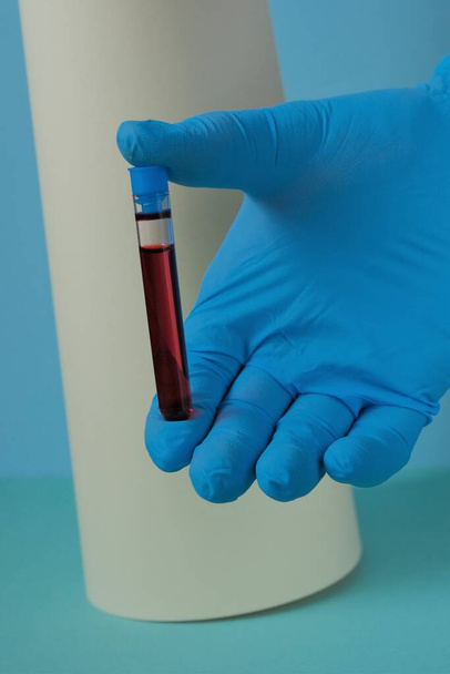 γιατρός κρατώντας εξέταση αίματος σε κοντινή απόσταση - Φωτογραφία, εικόνα