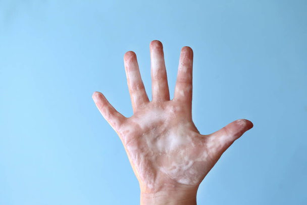 Schone handen. Hygiëne en gezondheid.Handwas Coronavirus epidemische waarschuwing - Foto, afbeelding