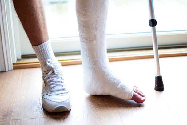 Een man met een stok met een gebroken been in een gips. - Foto, afbeelding