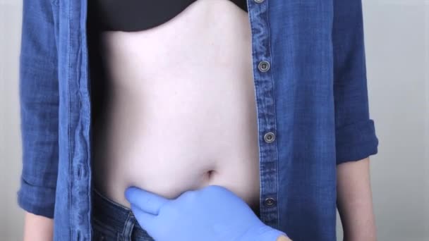 A woman suffers from pain in the appendix. Acute appendicitis, Crohn's disease, or inflammatory bowel disease. Surgeon examination and preparation for laparoscopic appendectomy - Footage, Video