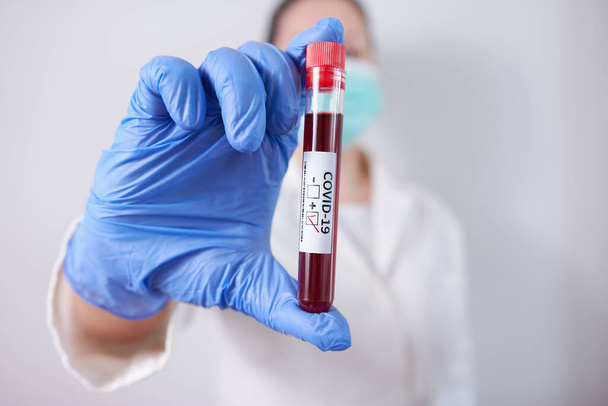 Lekarz posiadający pozytywną i negatywną próbkę krwi zakażoną Koronawirusem, noszący maskę i rękawiczki. Pandemia COVID-19 - Zdjęcie, obraz