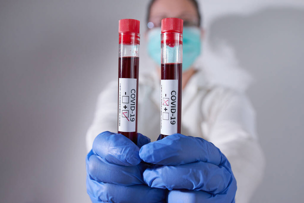 Lekarz posiadający pozytywną i negatywną próbkę krwi zakażoną Koronawirusem, noszący maskę i rękawiczki. Pandemia COVID-19 - Zdjęcie, obraz