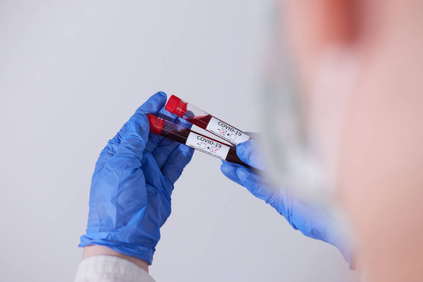 Médico sosteniendo muestra de sangre positiva y negativa infectada con Coronavirus, usando máscara y guantes. Pandemia COVID-19
 - Foto, Imagen