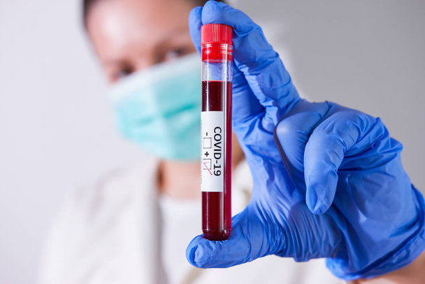COVID-19 Pandemia. Medico con campione di sangue infetto da Coronavirus.  - Foto, immagini
