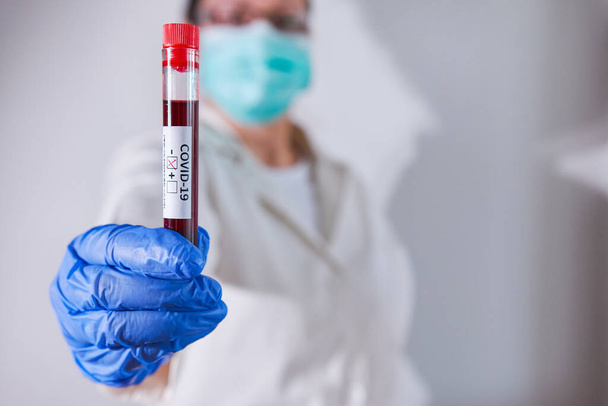 Médico sosteniendo muestra de sangre negativa infectada con Coronavirus, usando máscara y guantes. Pandemia COVID-19
 - Foto, Imagen